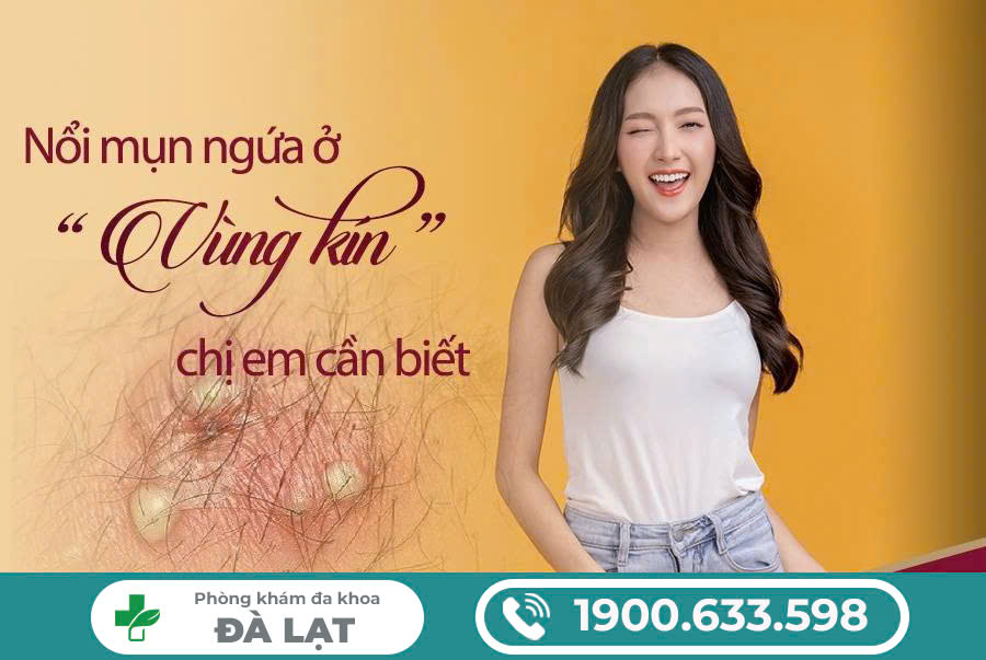 Hình ảnh minh họa